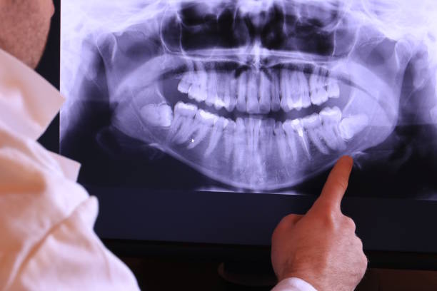 Best Emergency Denture Repair in Arlington, OH