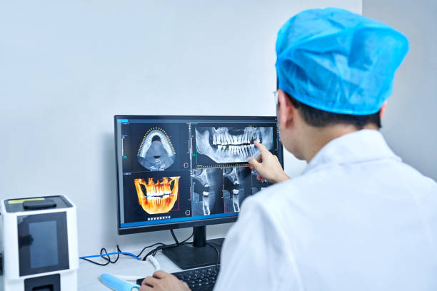 Best Emergency Wisdom Teeth Removal in Arlington, OH